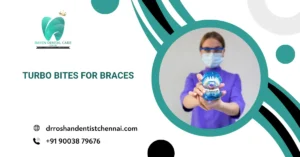 Turbo Bites for Braces
